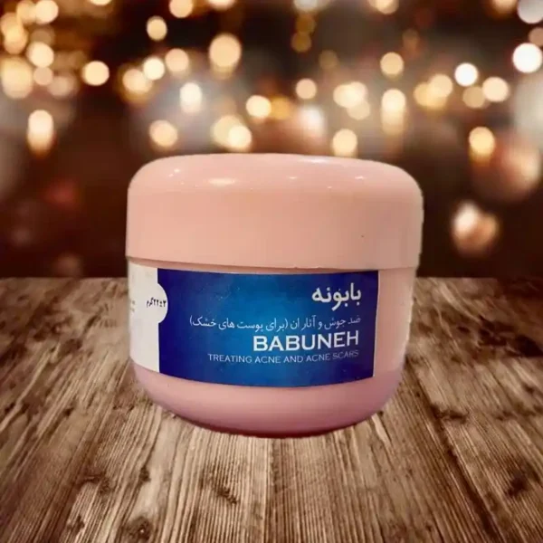 کرم ضد جوش و آثار جوش بابونه هلسی